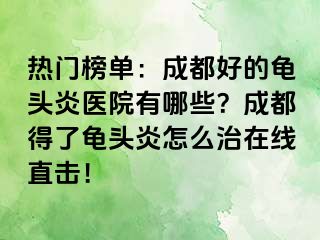 热门榜单：成都好的龟头炎医院有哪些？成都得了龟头炎怎么治在线直击！